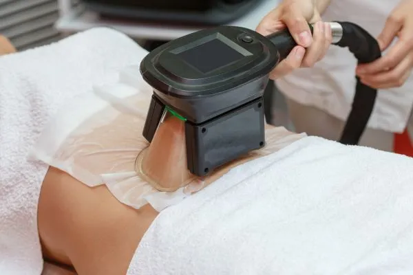 Image of person having fat freezing treatment to help weight gain Bibury