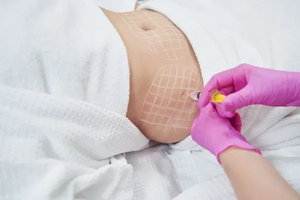 image of fat dissolving injections on love handles to help combat weight gain Bibury