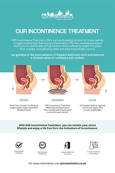 image of how urge incontinence Bibury treatment works